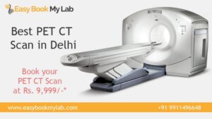 PET CT scan price in Delhi 