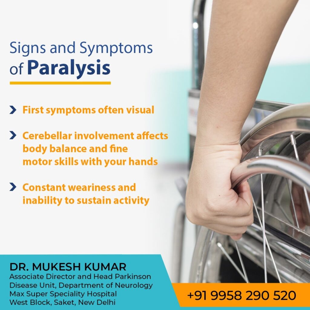 Paralysis treatment in Delhi 