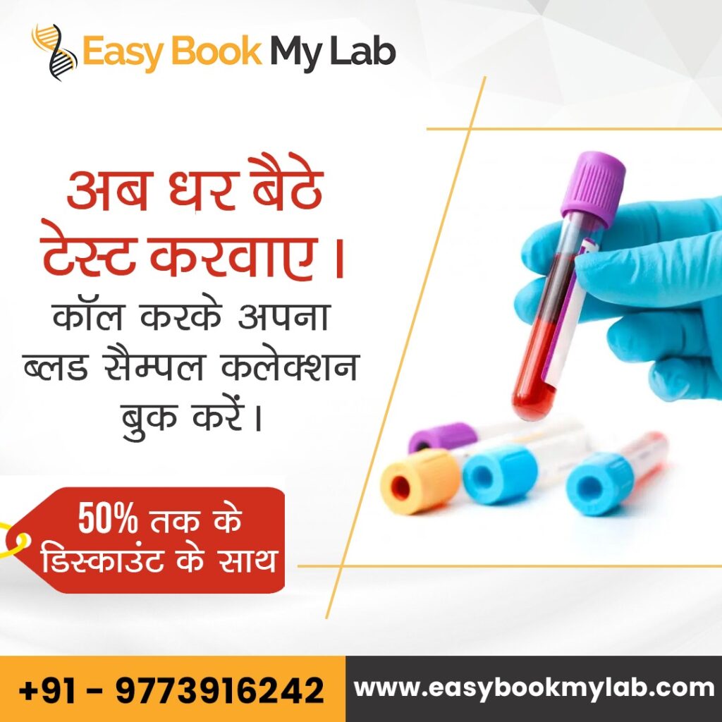 Best Blood Test Labs in Delhi