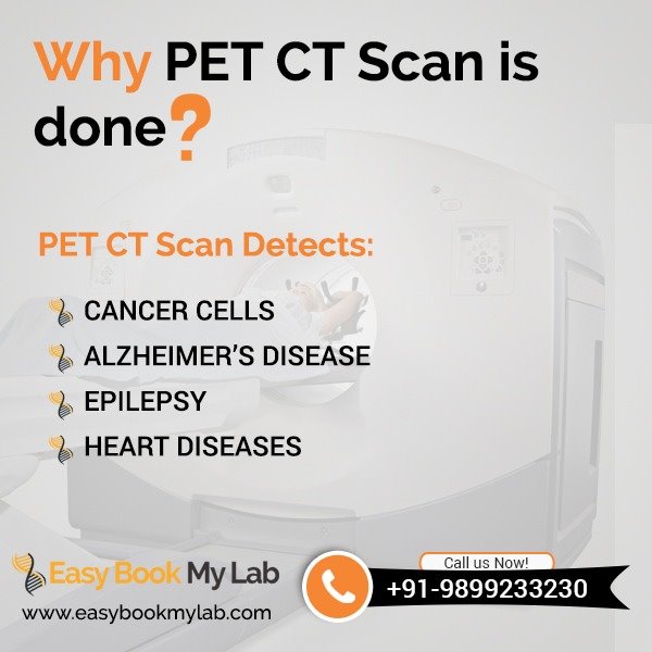 PET CT scan in Bangalore 