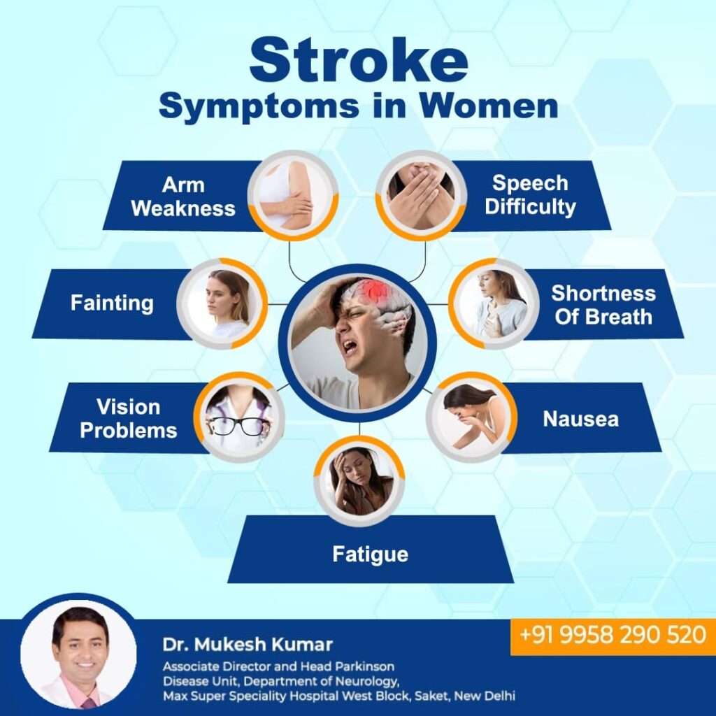 best brain stroke doctor in Delhi 