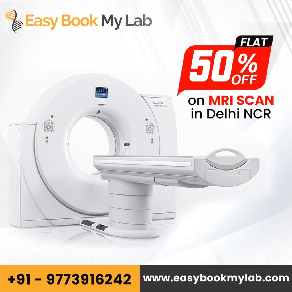 MRI scan cost in Delhi 