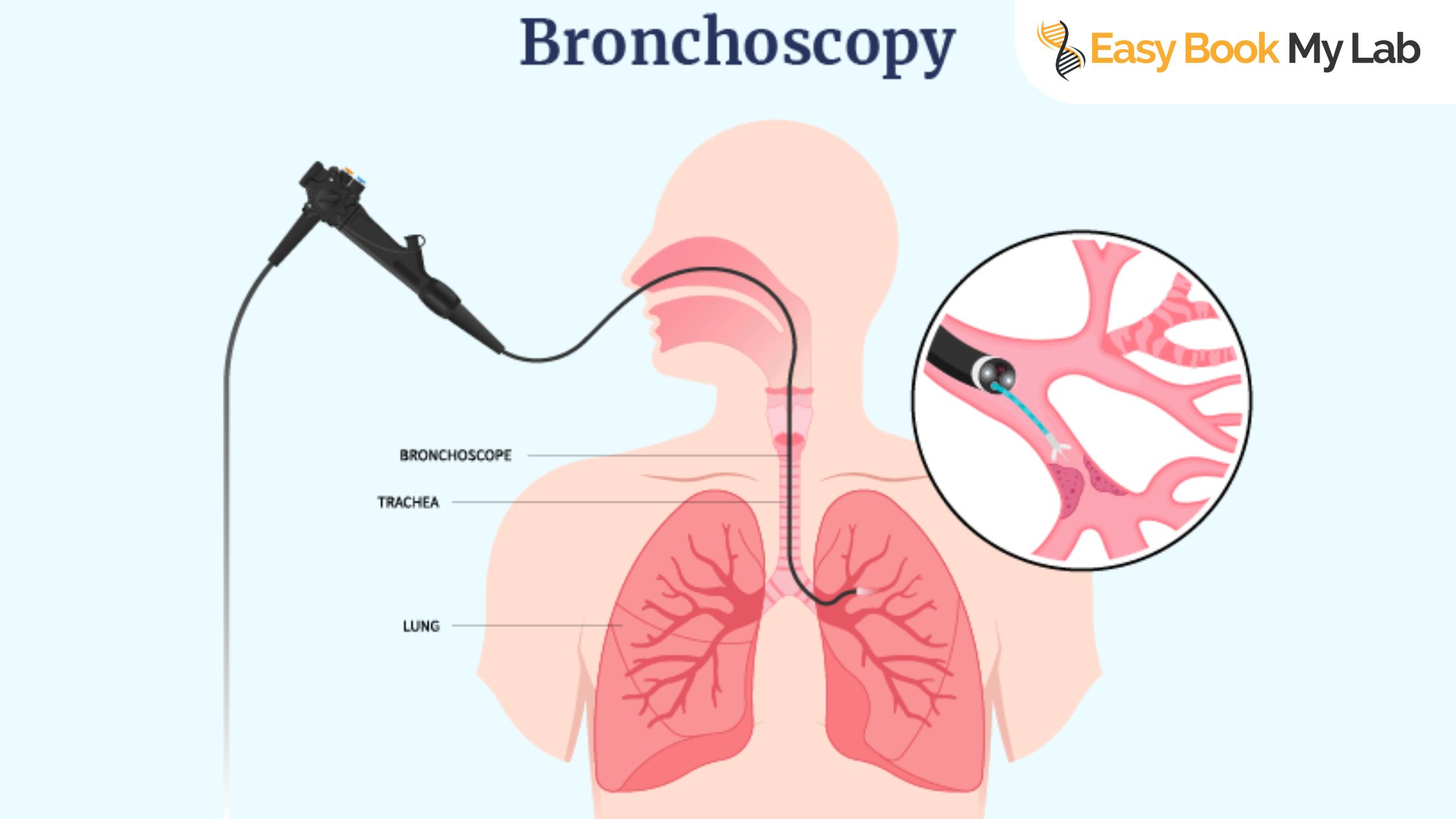 best bronchoscopy test centre in Delhi NCR